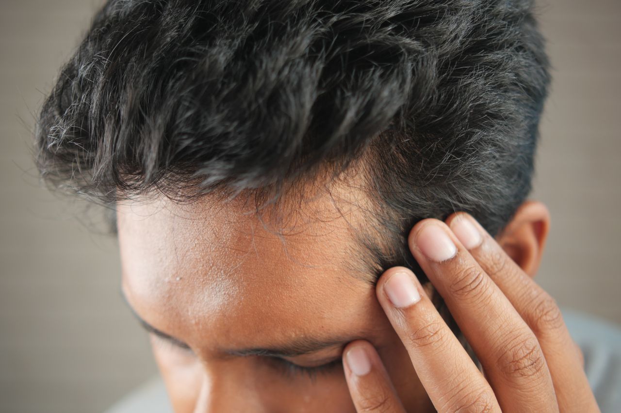 Man with dark hair holding his temple, showing hairline and early signs of hair loss near the forehead.